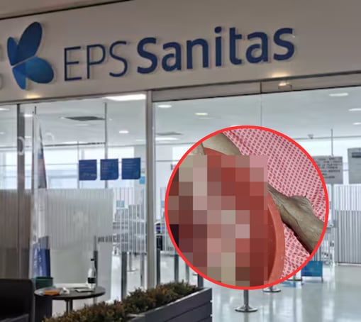 Adulta mayor a la espera de atención por parte de Sanitas: la IPS contratada no da respuesta.