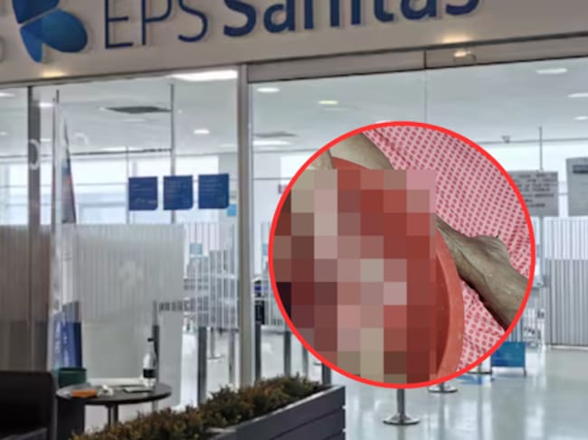 Adulta mayor a la espera de atención por parte de Sanitas: la IPS contratada no da respuesta.