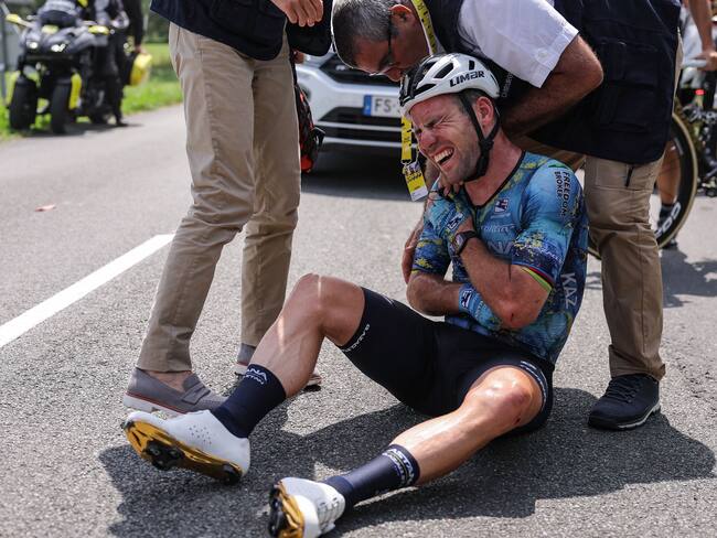 Mark Cavendish se duele de la clavícula luego de la caída que le obligó a abandonar el Tour. (Photo by THOMAS SAMSON/AFP via Getty Images)