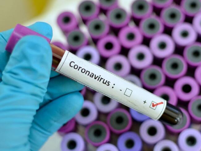 Atlántico reportó más de 2.600 casos de coronavirus
