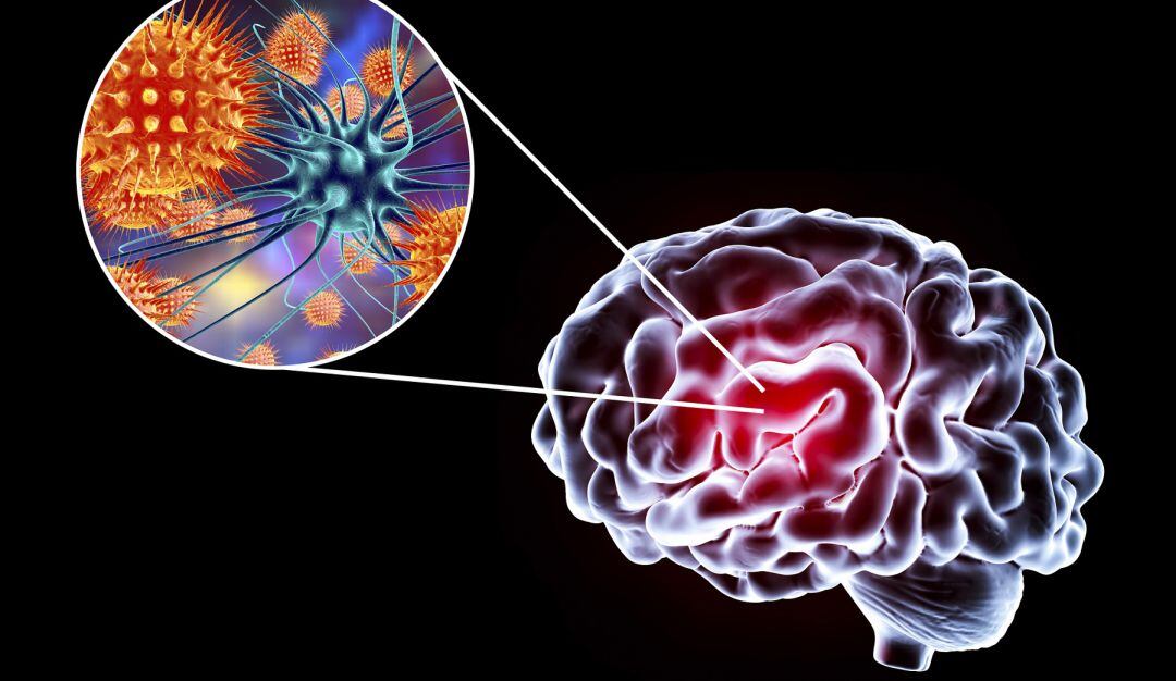 ¿Cómo afecta la COVID-19 al sistema nervioso aún después de superarse?