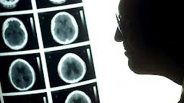 Cáncer: una nueva forma de empezar a vivir