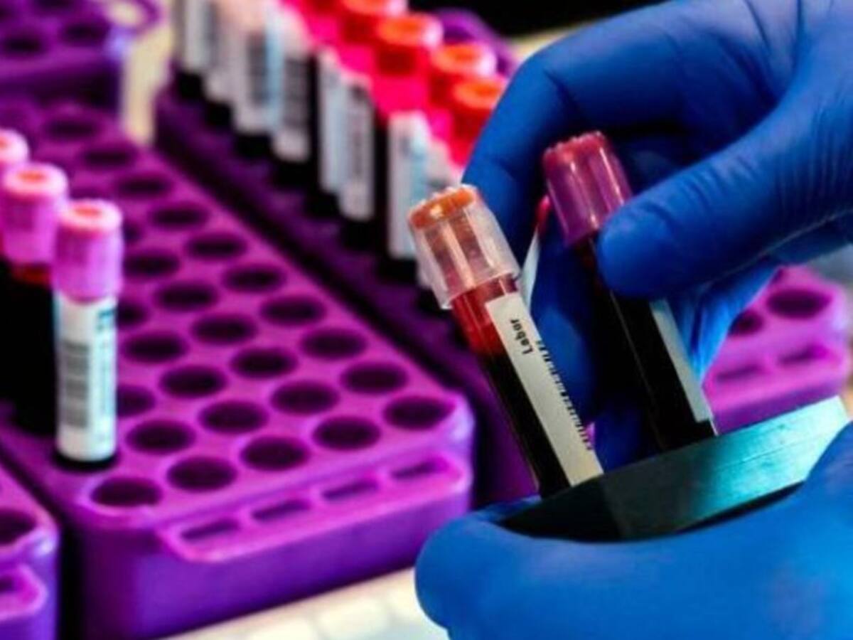 Se confirmó el primer caso positivo de COVID-19 en Belén de Umbría