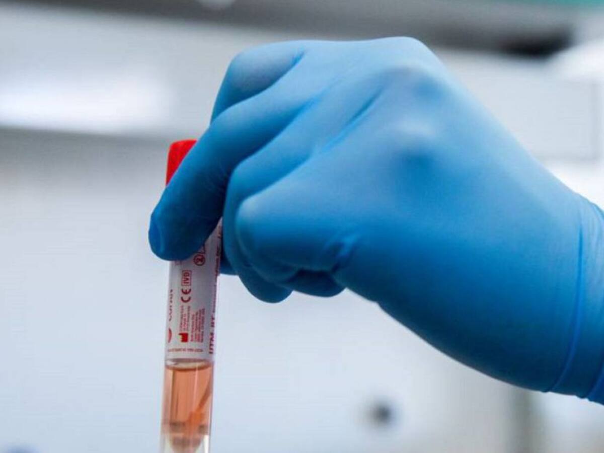 El Quindío superó los 3.000 casos activos de COVID-19