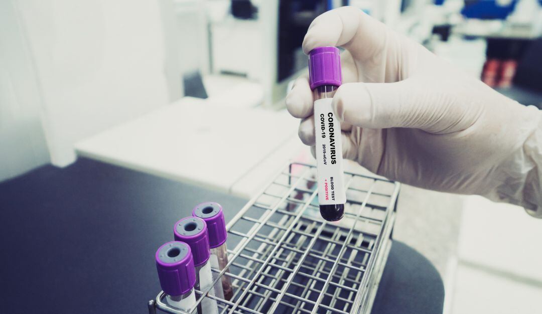 Imagen de referencia