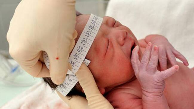 bebé durante control de perimetro cefálico