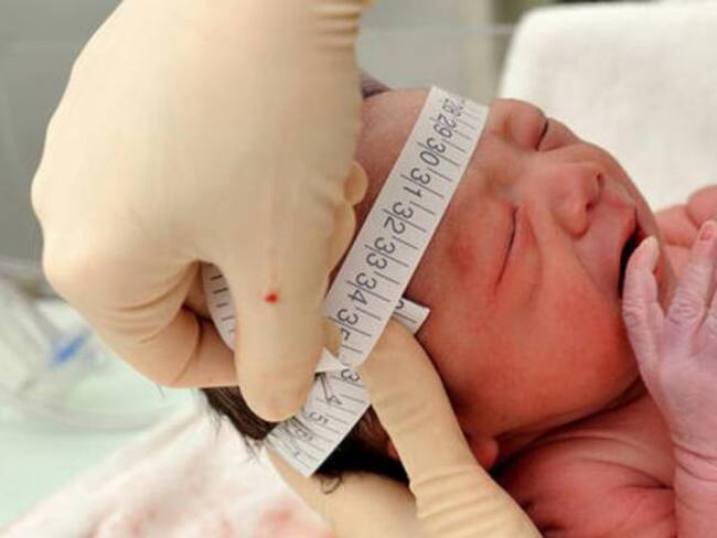 bebé durante control de perimetro cefálico