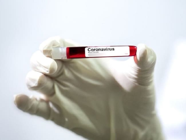 Norte de Santander reporta 121 casos de Coronavirus