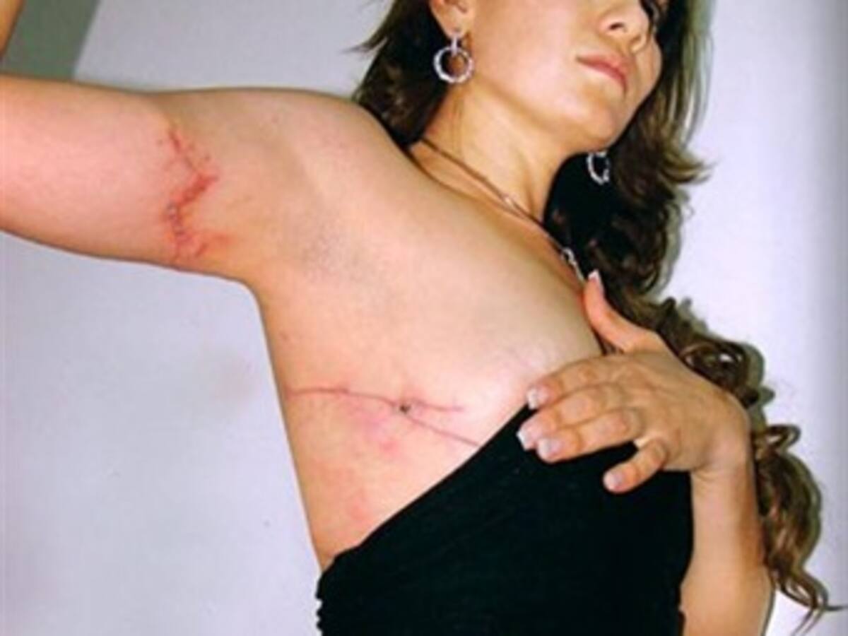 Alcaldesa muestra su cuerpo herido a un año de un atentado en su contra