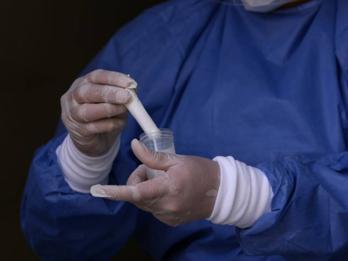 El Meta iniciará plan piloto con toma de muestras en pacientes asintomático