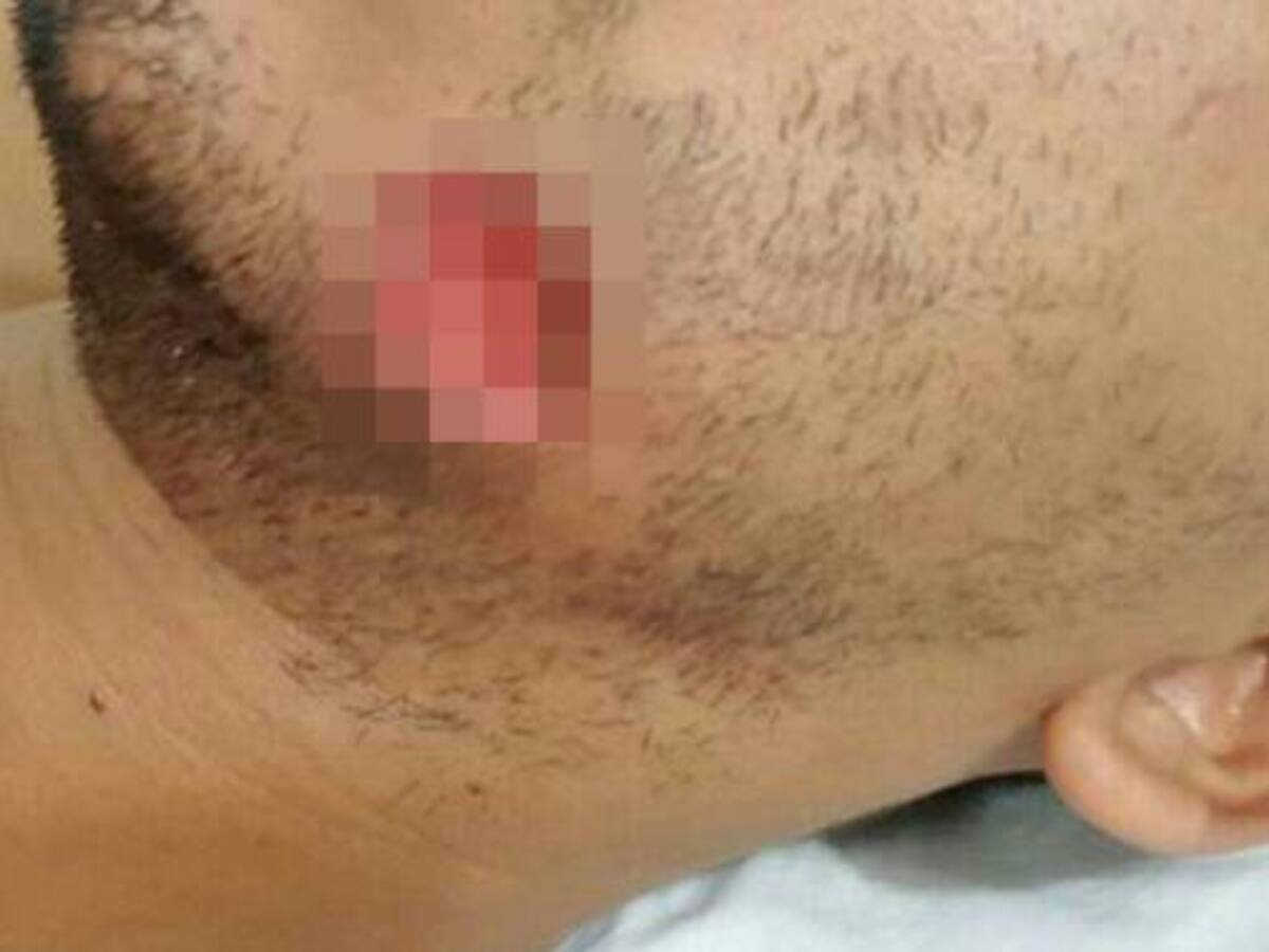 Acusan de ataque caníbal a candidato liberal a la Asamblea de Guanía