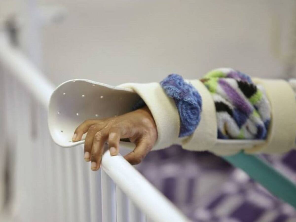 Ya son 30 quemados por pólvora en Antioquia