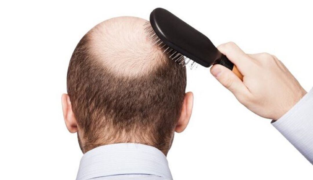 ¿Cómo evitar la caída del pelo?