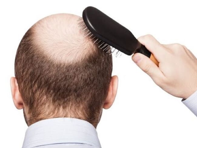 ¿Cómo evitar la caída del pelo?