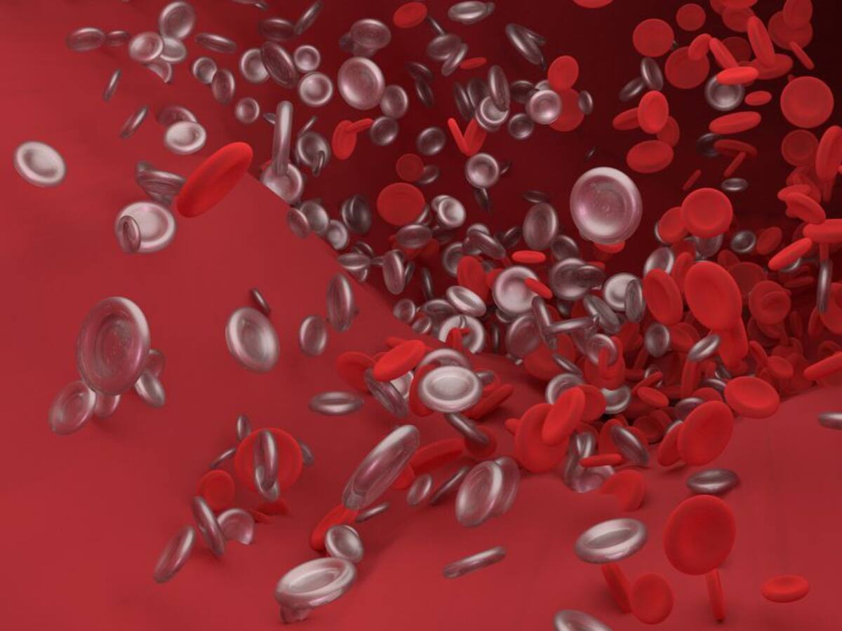 Tipos, factores y causas de la trombosis