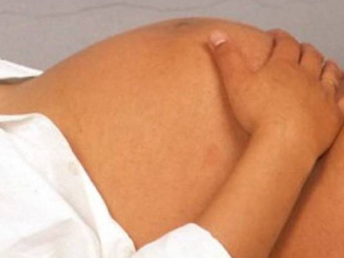 Cundinamarca toma medidas para esclarecer muertes de mujeres gestantes
