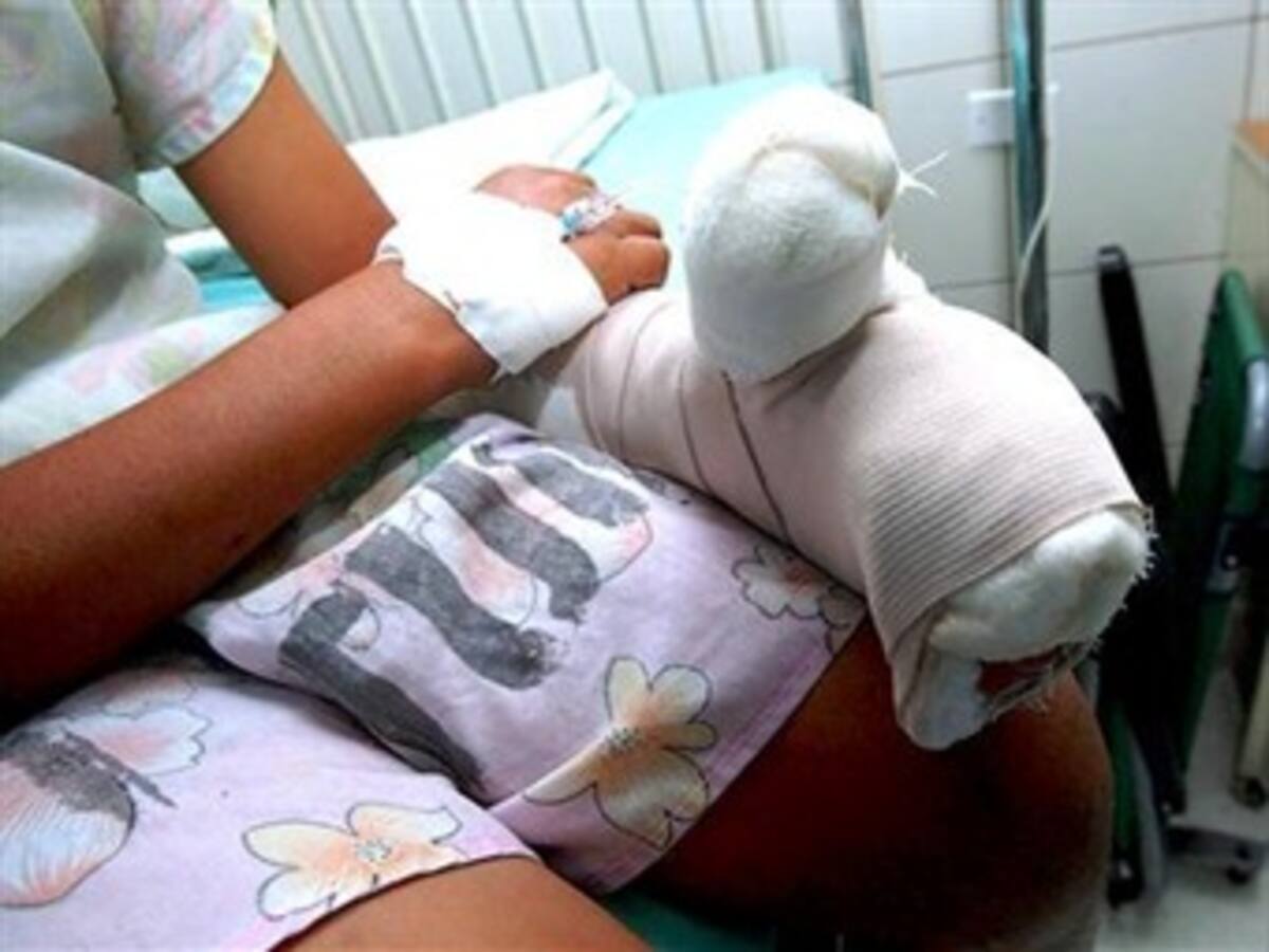 11 nuevos casos de niños quemados por pólvora, ya van 253 en total en diciembre