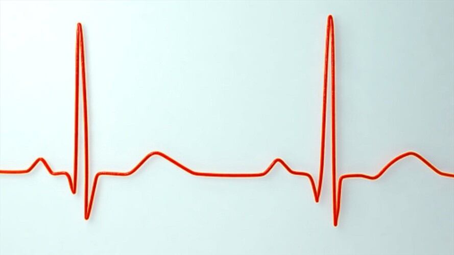 Hipertensión- Imagen de referencia. Foto: Getty Images