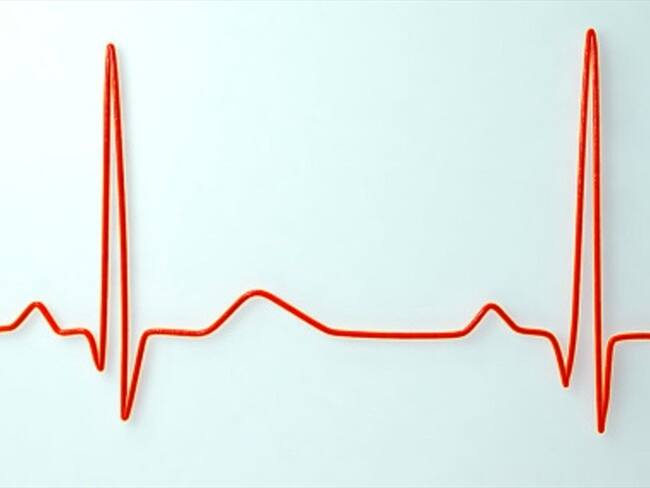 Hipertensión- Imagen de referencia. Foto: Getty Images