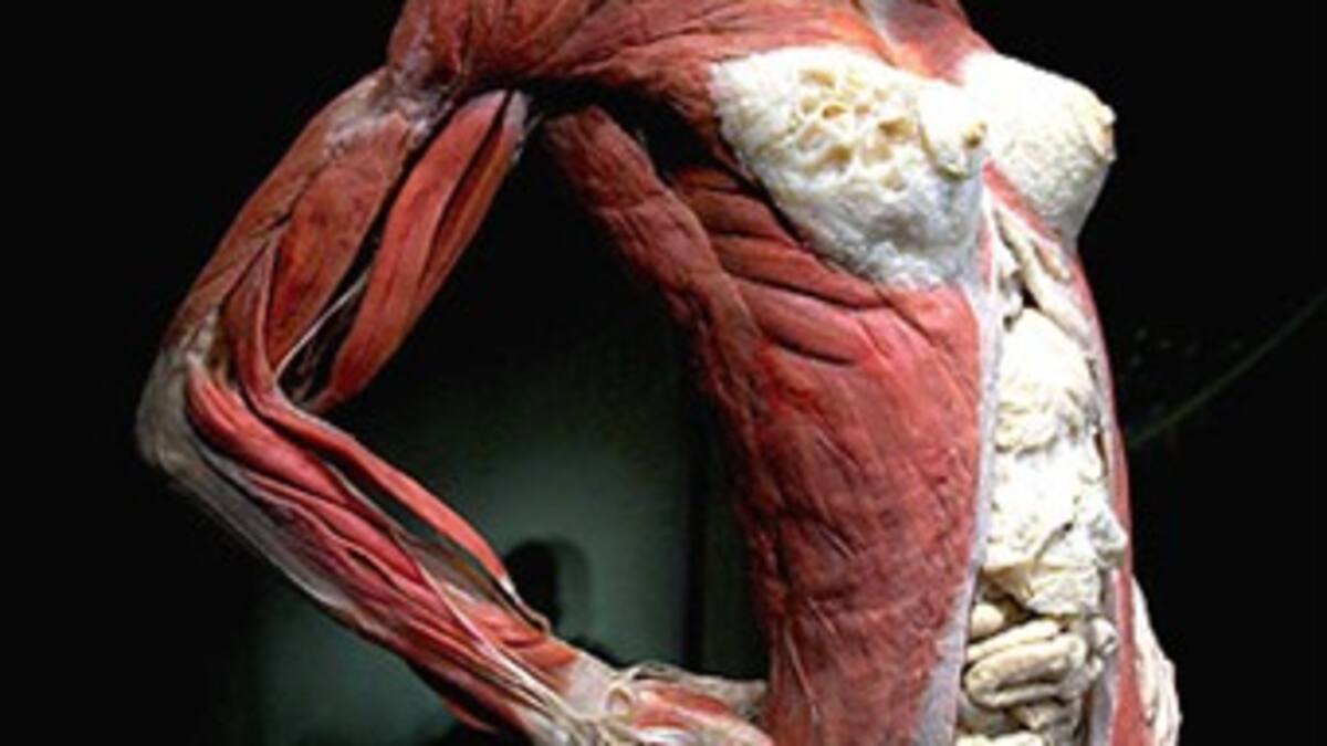 Unos cadáveres copulando crean polémica en una muestra en Berlín