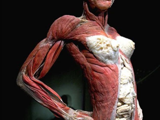 Unos cadáveres copulando crean polémica en una muestra en Berlín