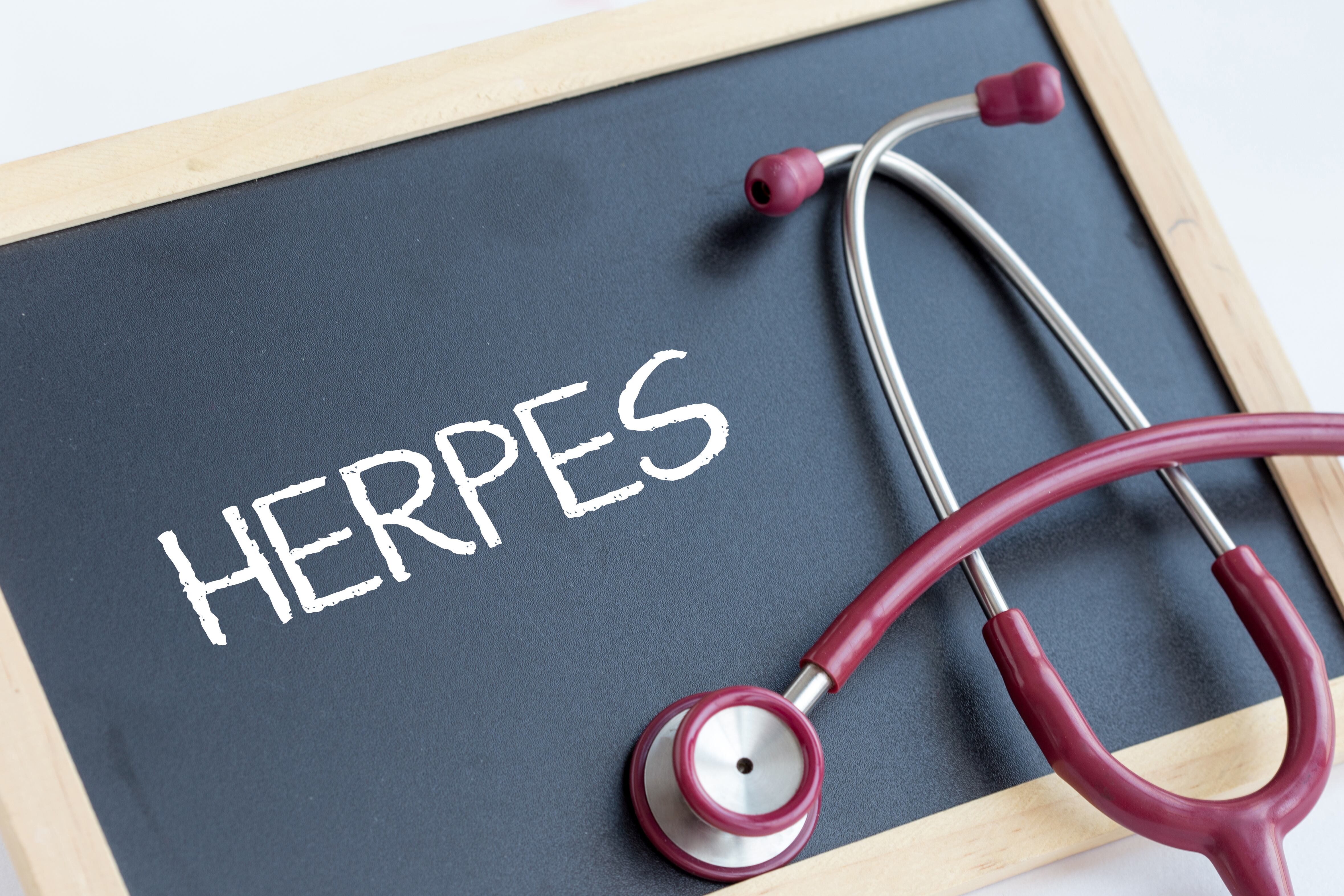Herpes genital - Getty Images