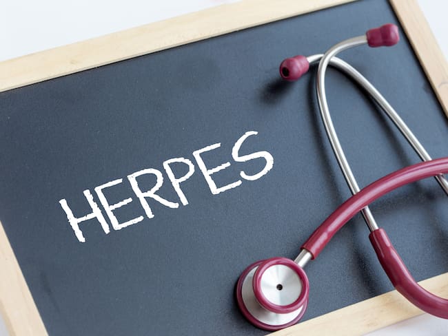 Herpes genital - Getty Images
