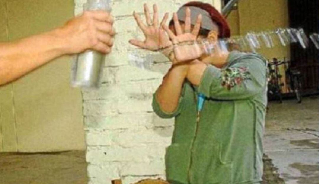 Ataque con ácido. Foto: Colprensa. Según el ente judicial, habría fingido ser víctima de un ataque con ácido en abril de 2023 en Tunja.