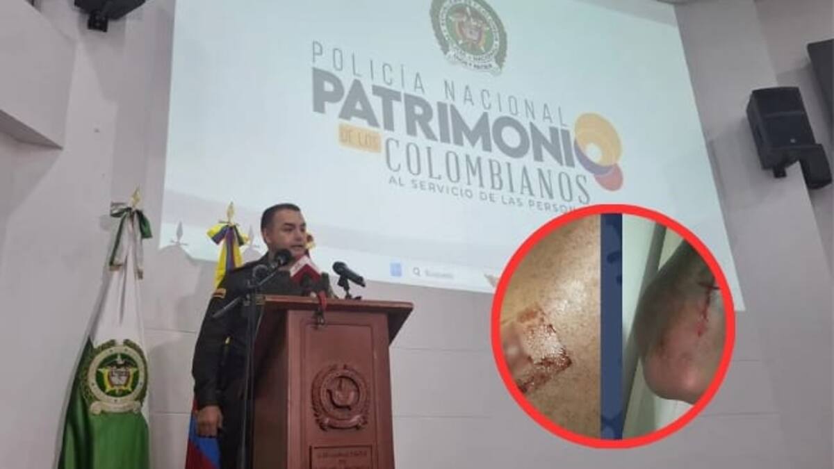 Comandante de la Policía del Quindío, coronel Luis Fernando Atuesta