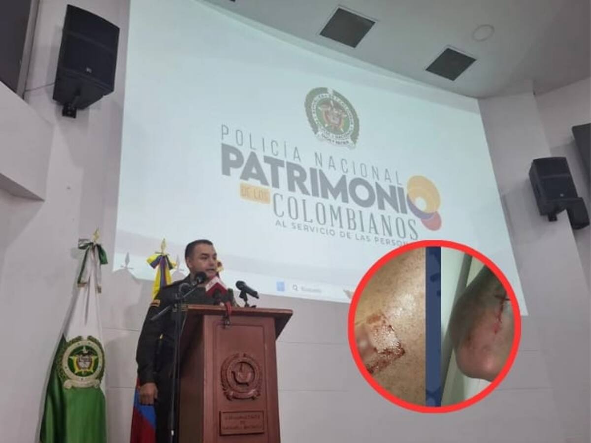 ¿Qué dijeron las autoridades sobre la agresión a un jugador del Deportes Quindío?