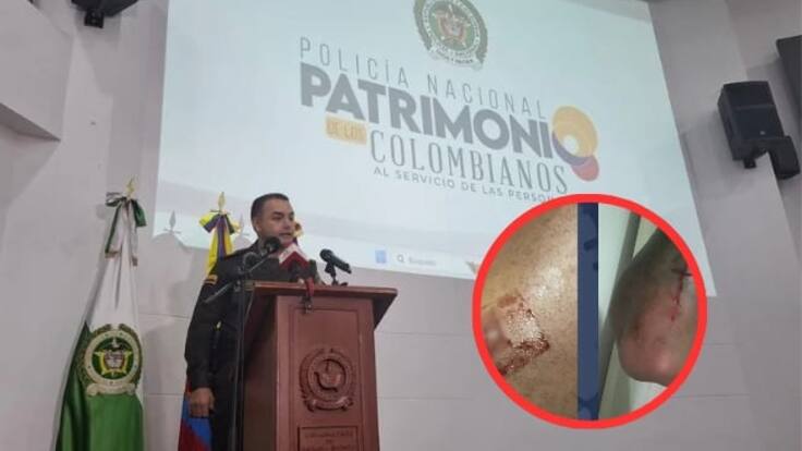 Comandante de la Policía del Quindío, coronel Luis Fernando Atuesta