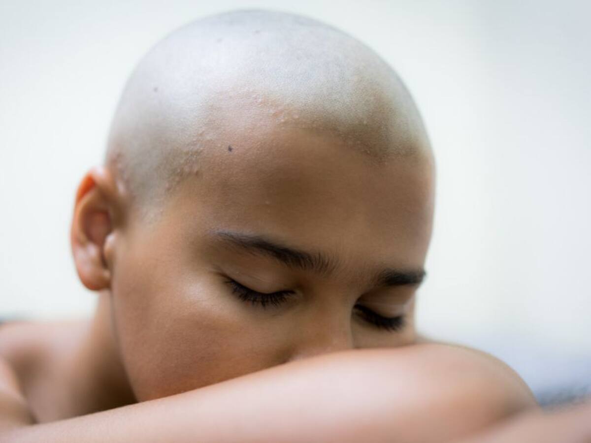 10 señales más frecuentes del cáncer que pueden pasar desapercibidas