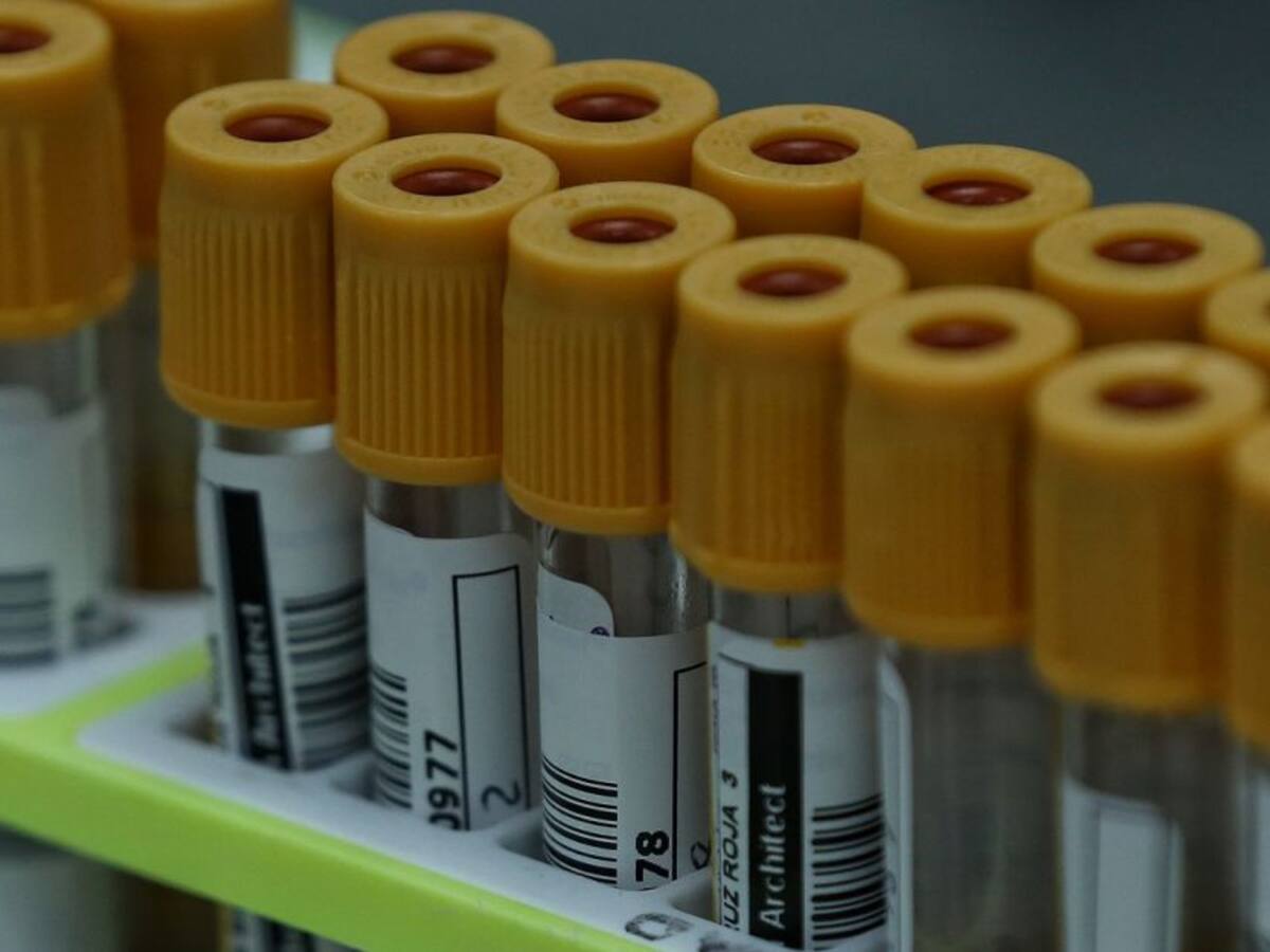 Desactualización de datos de EPS genera demora de resultados en Cartagena