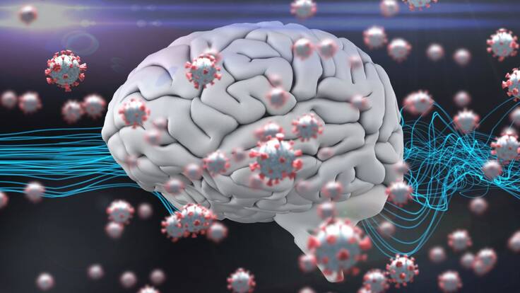 ¿Qué puede causar en el cerebro la COVID-19?