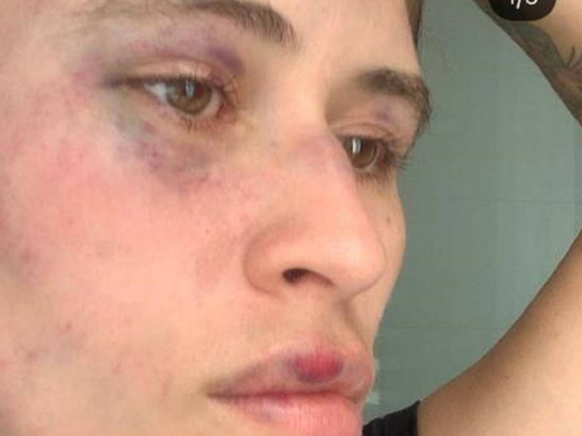 Agresor de exnovia en Santander pidió perdón