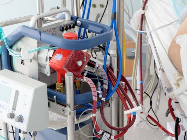 Sistema de Oxigenación de membrana Extracorpórea