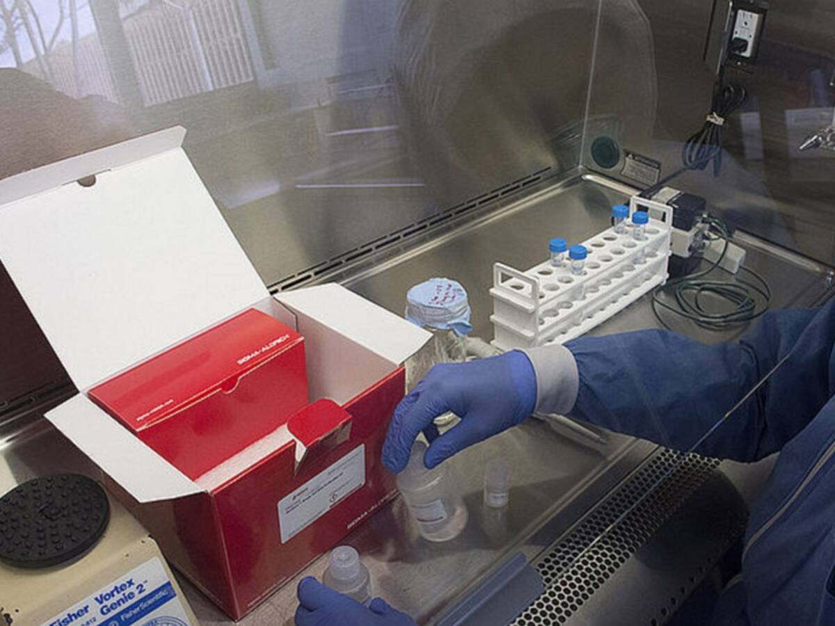 "Kit in house" es un método alterno para diagnóstico de COVID-19