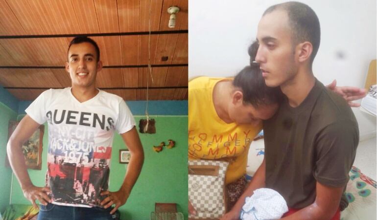 Ricardo Haidy Rodríguez Suarez de 18 años antes de ingresar a la Policía y ahora en la clínica