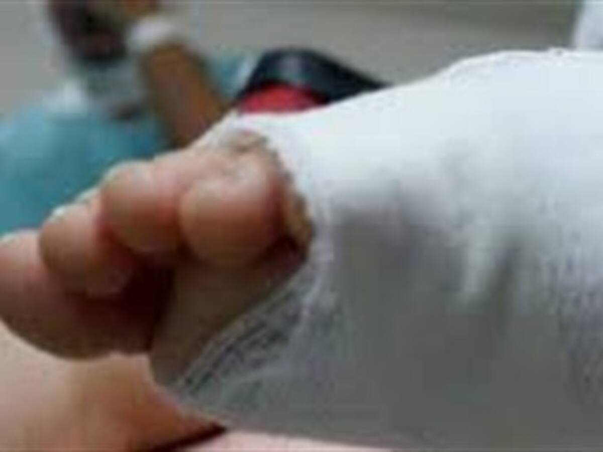 Ya son 38 los quemados en el valle