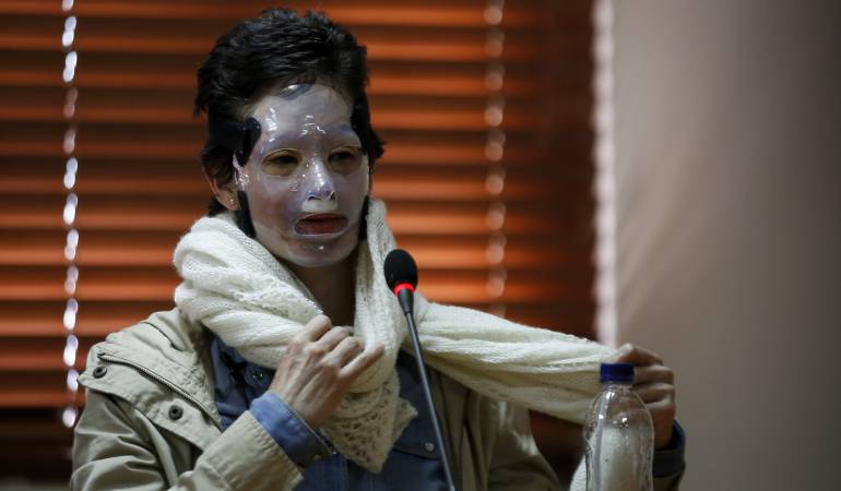 Natalia Ponce fue víctima de un ataque con ácido 