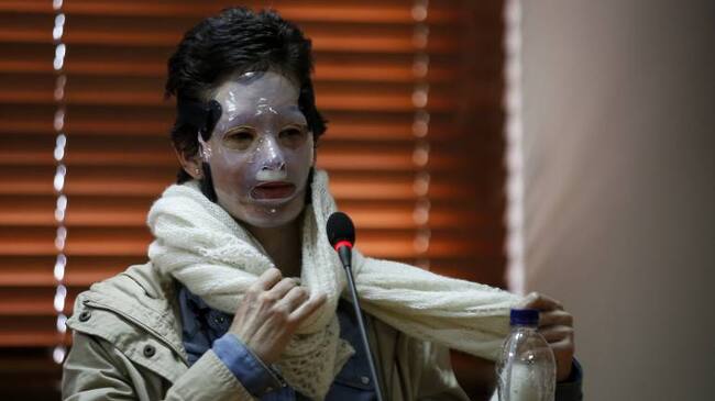 Natalia Ponce fue víctima de un ataque con ácido