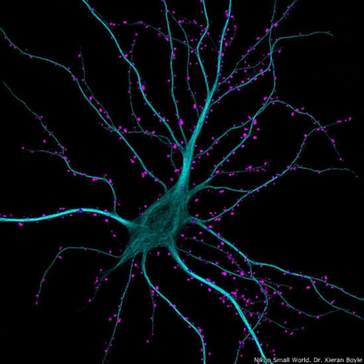 4º - Rogelio Moreno Gill, de Ciudad de Panamá. Imagen de de un paramecio (Paramecium) mostrando su núcleo, boca y vacuolas de expulsión de agua.
