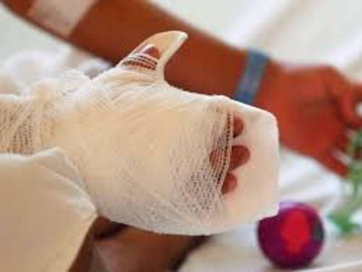 IDS alerta por uso de pólvora y graves secuelas en menores en Norte de Santander