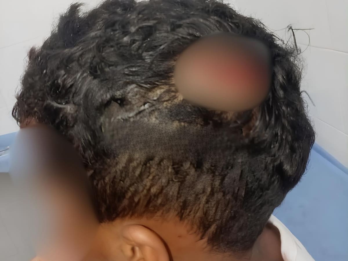 Tres menores resultaron heridos cuando les cayó un ventilador en escuela en deterioro de Yondó