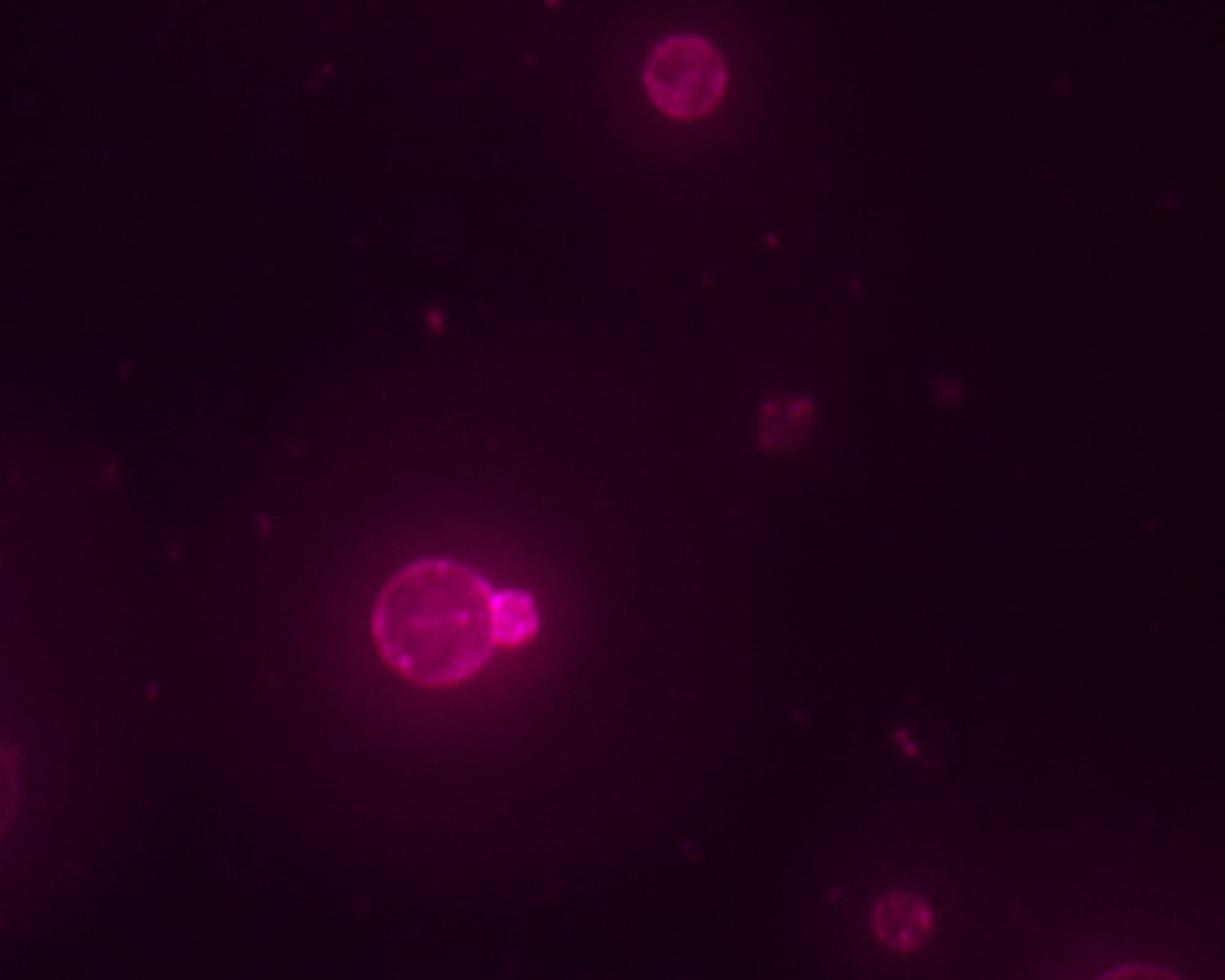 Una célula sintética ensamblada a partir de componentes químicos no vivos. La membrana roja está teñida con un colorante. 
(Foto: Cortesía Orion Venero/Laboratorio Adamala )