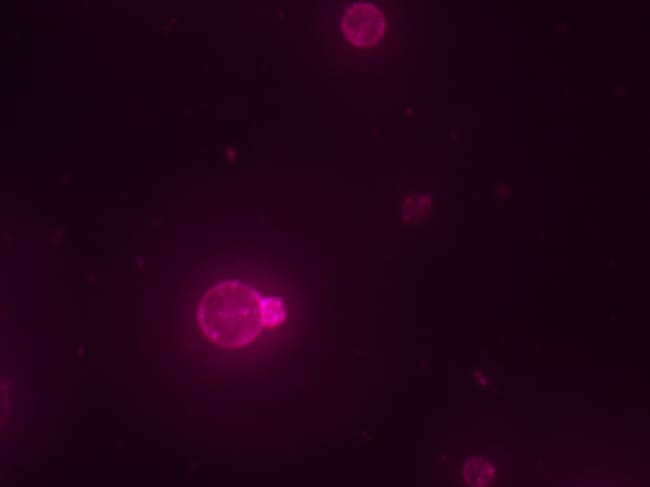Una célula sintética ensamblada a partir de componentes químicos no vivos. La membrana roja está teñida con un colorante.
(Foto: Cortesía Orion Venero/Laboratorio Adamala )