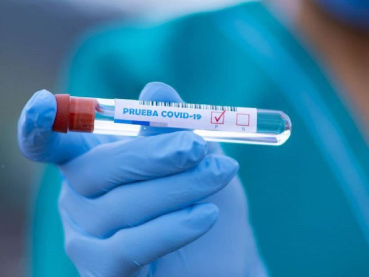 Alerta en Quindío por circulación de variante brasilera del COVID