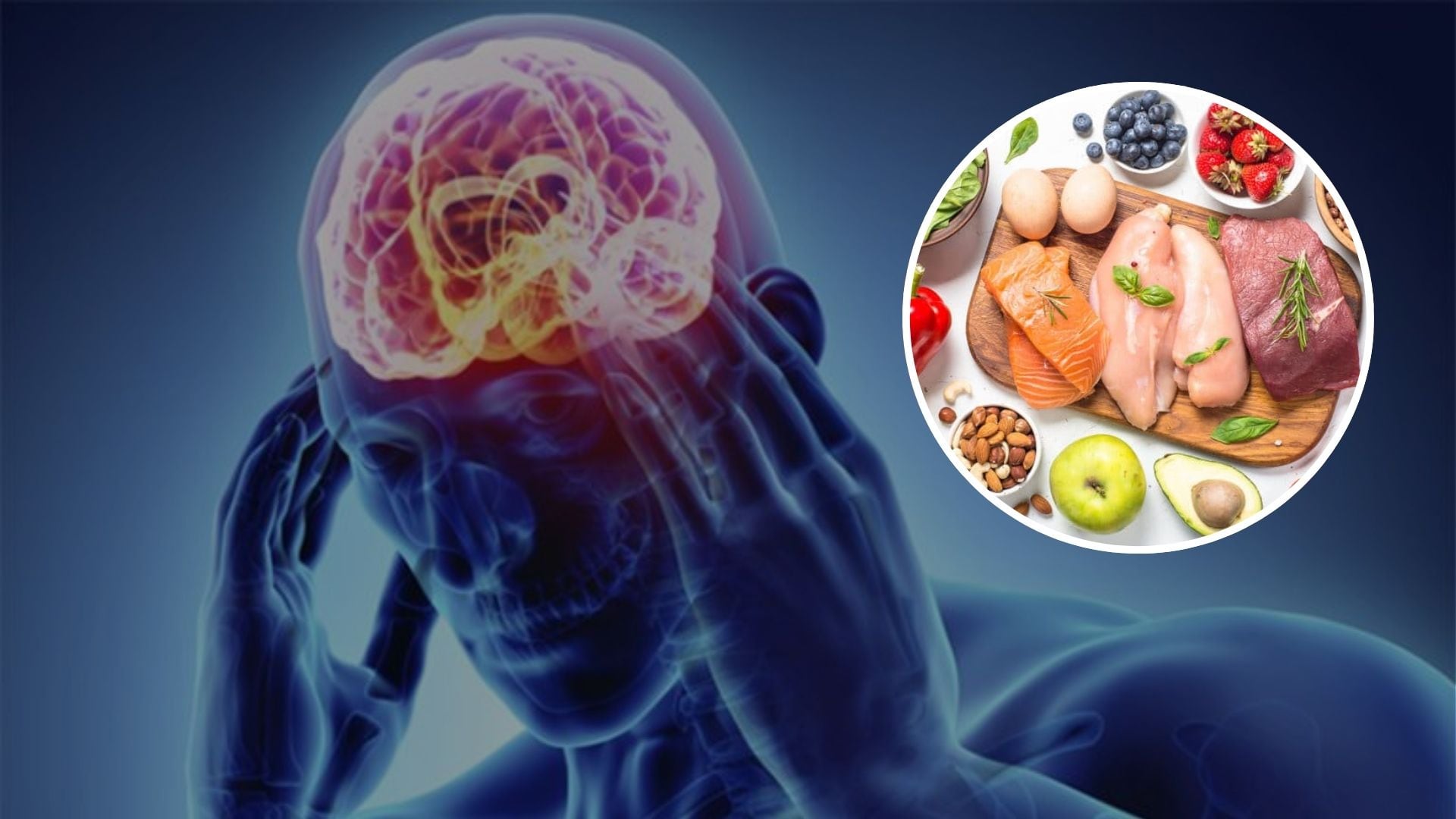 Avance de la terapia cetogénica en casos de epilepsia farmacorresistente