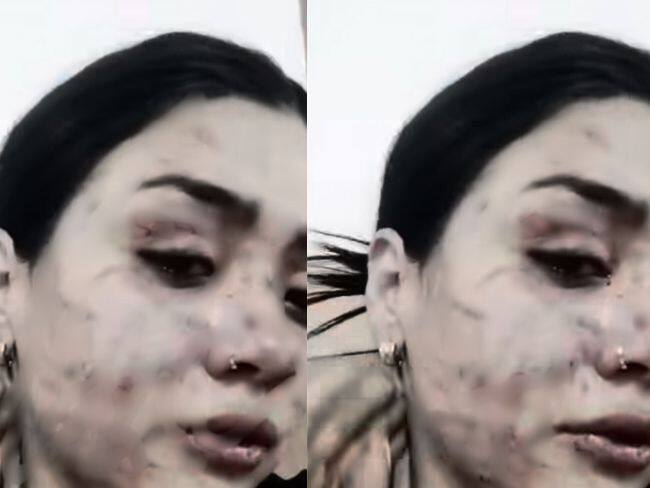 Vendedora denuncia grave ataque en su rostro por parte de otras vendedoras en el centro de Bogotá