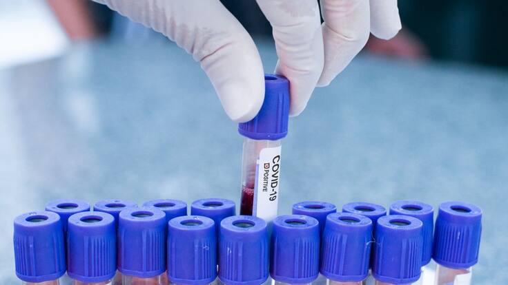 Argentina avanza en la creación de un tratamiento para el Covid-19